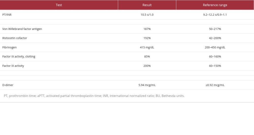 Coagulation profile of the patient during index admission. It highlights normal PT, prolonged aPTT, reduced factor VIII activity, and increased factor VIII inhibitor levels. D-dimer elevation was felt to be secondary to large soft tissue hemorrhage.