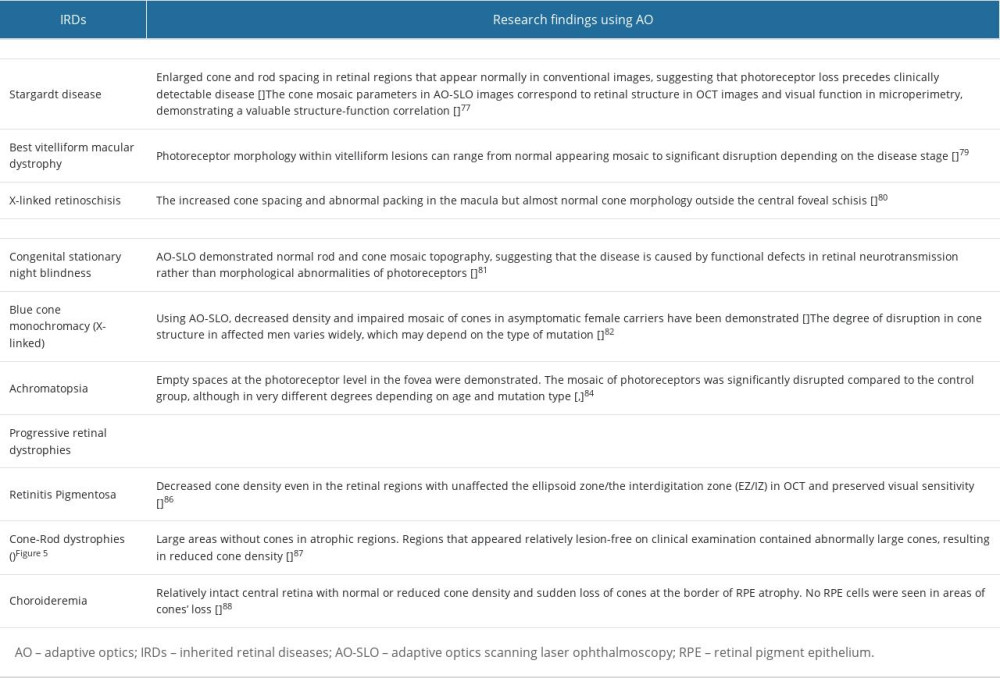 Examples of using AO in IRDs.