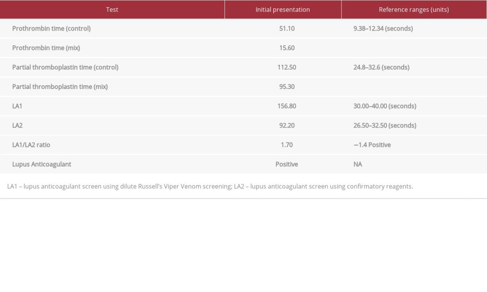 1: 1 Mixing study of PT and PTT along with lupus anticoagulant detection tests.